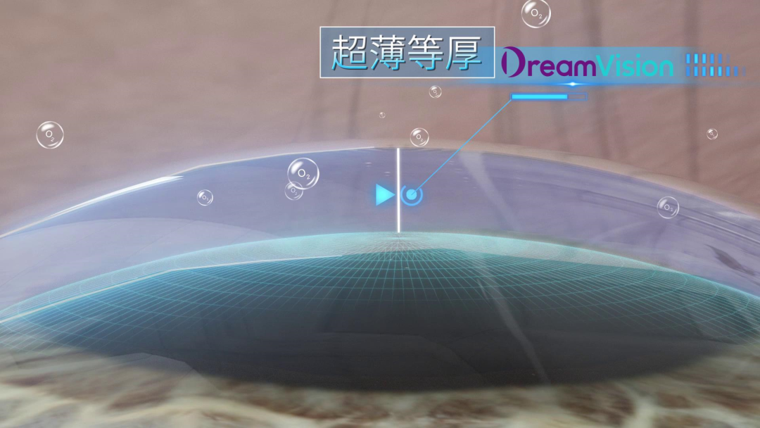 ballbet������(�й�)����ɭ����