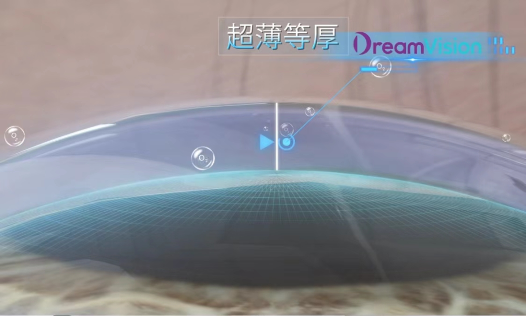 ballbet������(�й�)����ɭ����